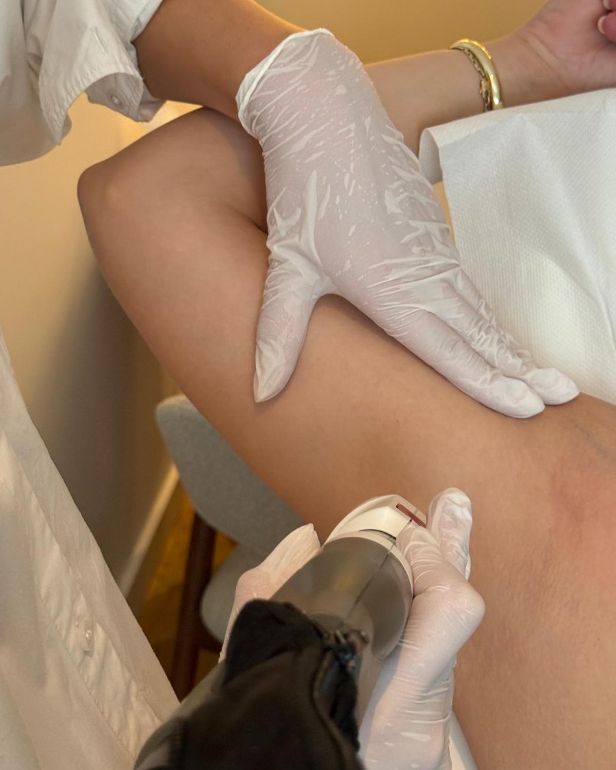 Laserontharing behandeling bij NUM Skin Clinic
